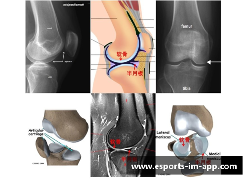 滑膜炎困扰体育明星的运动生涯与康复之路探讨